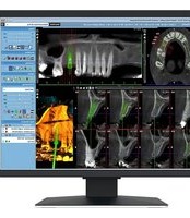 Notice EIZO RADIFORCE MX217 Moniteur