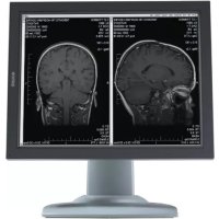 Barco MDNG2121 - Moniteur