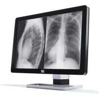 Coronis Fusion 10MP Barco