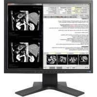 EIZO RadiForce MX194 - Moniteur