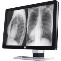 Coronis Fusion MDCG10130 Barco