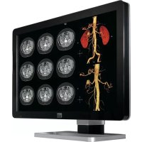 Coronis Fusion MDCC4330 Barco