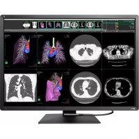 EIZO RadiForce RX1270 - Moniteur