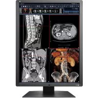 EIZO RadiForce RX250 - Moniteur