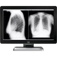 Coronis Fusion MDCC6430 Barco