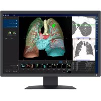 RadiForce MX243W EIZO