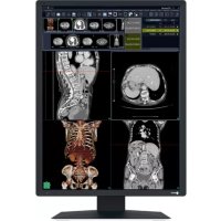 EIZO RadiForce RX270 - Moniteur