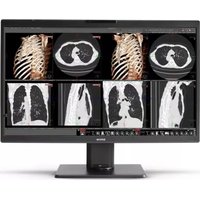 Notice Barco NIO FUSION 8MP MDNC-8132 Moniteur