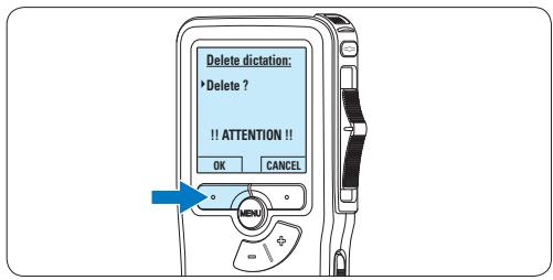 PHILIPS LFH9120 - Eendictaat verwijderen - 4