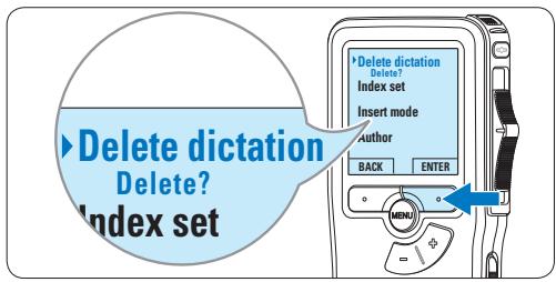 PHILIPS LFH9120 - Cancellation di un dettato - 3