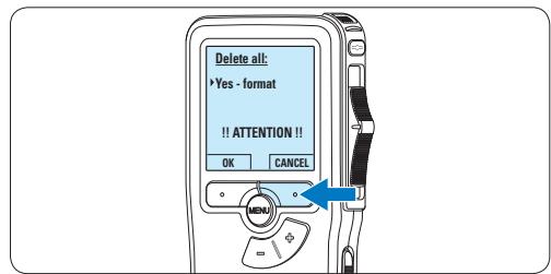 PHILIPS LFH9120 - Een neue geheugenkaart formatteren - 2