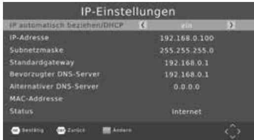 PHILIPS DV3T2 - Paramètres IP - 1