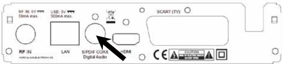 PHILIPS DV3T2 - Raccordement à une chaine HiFi - 1