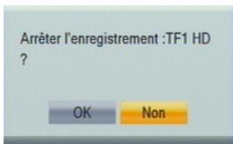 CGV ETIMO 2T - Arrêter un enregistrement - 1