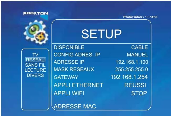 PEEKTON PEEKBOX 4 MKII - Se connecter au réseau filaire (port Rj45) (suite) - 1