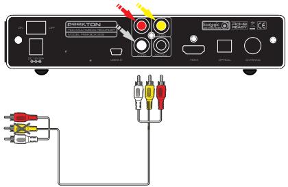 PEEKTON PEEKBOX 206 - Connexion audio analogue - 1