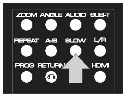 PEEKTON PK 6700 - Fonction AUDIO - 1