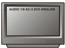 PEEKTON PK 9004 - Fonction AUDIO - 1