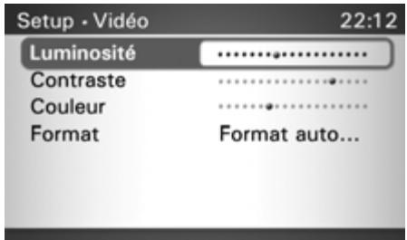 BECKER TRIVISION 7970 - Remarque - 1