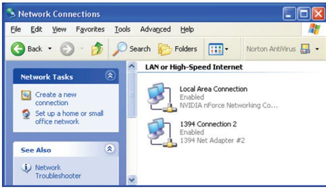 FUJITSU SIEMENS ACTIVY MEDIA SERVER 150 - How to configure your PCs IP address. - 1