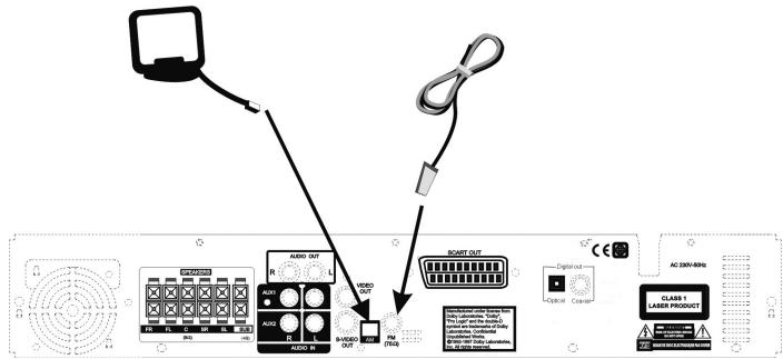 CLATRONIC DVD 552 HC - AM reception: - 1