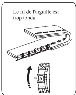 E&R CLASSIC E&R CLASSIC KP10 - Réglage de la tension du fil - 3