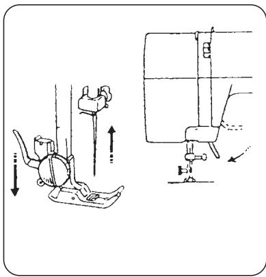 E&R CLASSIC E&R CLASSIC KP12 - Changement d'aiguille - 1