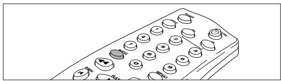 PHILIPS CDR200BK - Shuffle (random order) play - 1