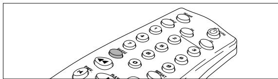 PHILIPS CDR200BK - Reproduccion al azar (orden aleatorio) - 1
