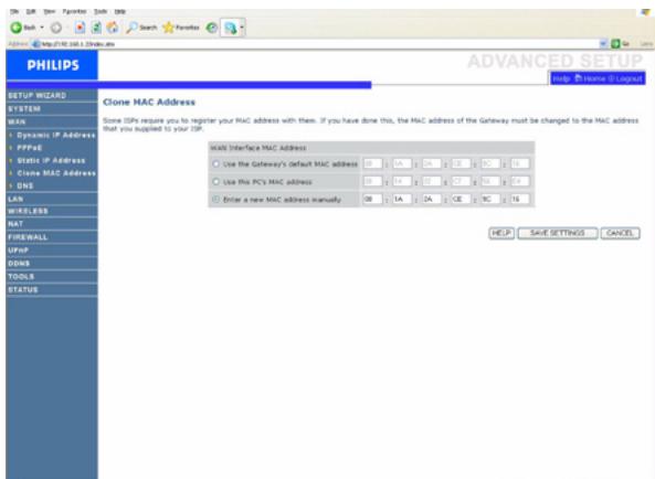 PHILIPS CAW7740N - Adresse IP statique/Static IP Address - 2