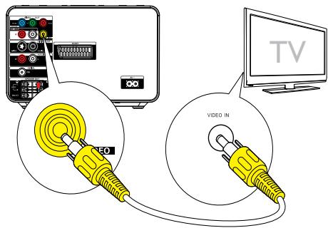 PHILIPS MCD183 - Option 4 : connexion vidéo composantes - 1