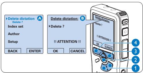 PHILIPS LFH0955 - Cancellation di un dettato - 1