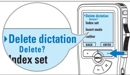 Delete dictation Delete? Index set