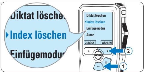 PHILIPS LFH9398 - Löschen einer Indexmarkierung - 2