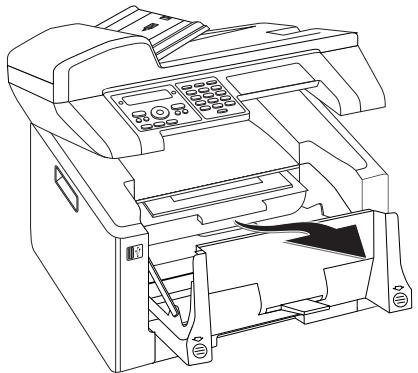 PHILIPS SFF6170DW - Remove the Packaging Material from the Toner Cartridge - 3