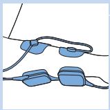 PHILIPS PR3094/00 - Elektroden und TENS-Komponenten befestigen - 5