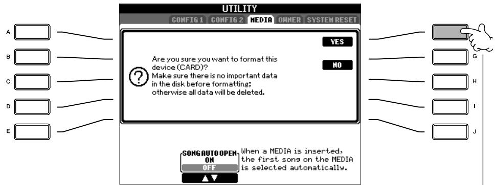 SONY CVP305 - Messages affichés à l'écran - 1
