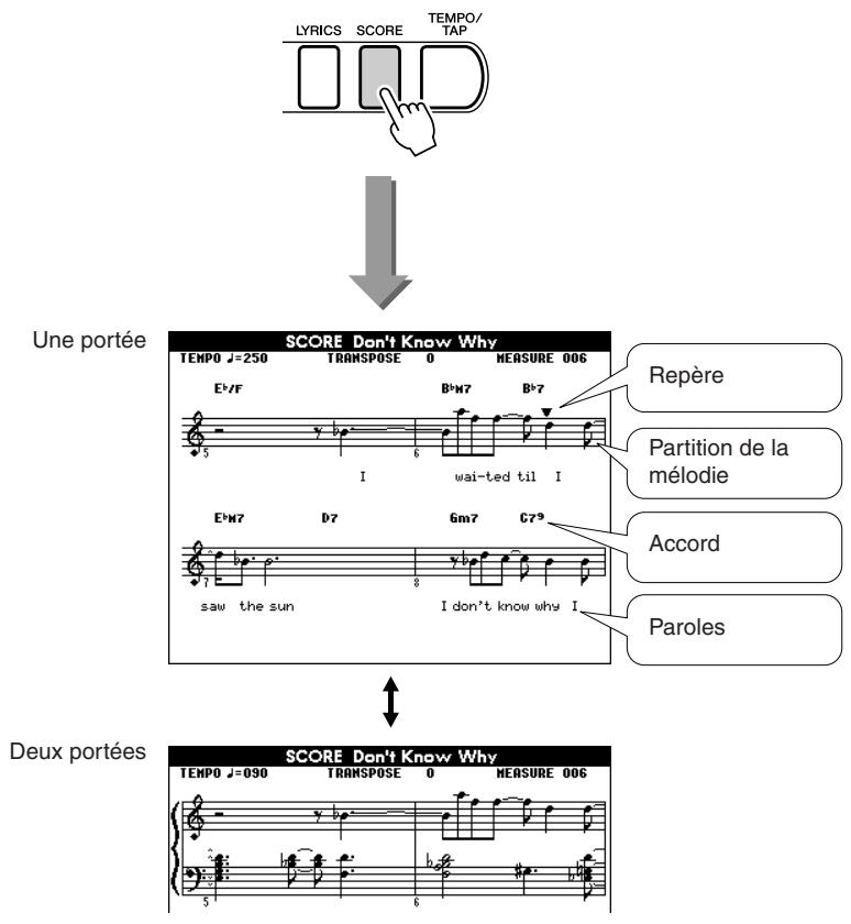 SONY DGX505 - Appuyez sur la touche [SCORE] pour faire apparaître une partition à une seule portée. - 1