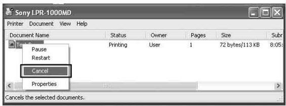 SONY LPR-1000MD - Right-click the name of the job you wish to control. A drop down list appears. - 1
