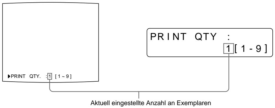 SONY UP-50 - Einstellen der Druckmenge - 2