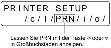 SONY UP-50 - Einstellen des Farbtons der Ausdrucke - 3