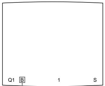 SONY UP-50 - Saisie d'une autre image pendant une impression - 2
