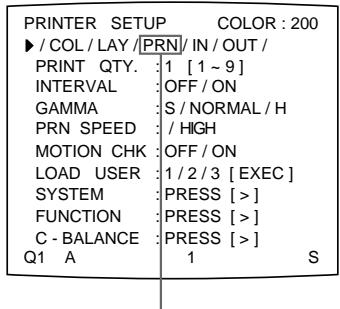 SONY UP-50 - Festlegen, wie die Bilder in den Speicher gestellt werden - 2