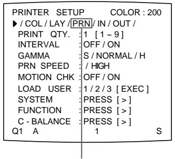 SONY UP-50 - Adjusting the tone of the printout - 2