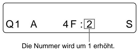 SONY UP-50 - Starten Sie an der Videoquelle die Wiedergabe. - 3