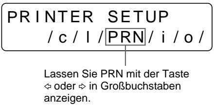 SONY UP-50 - Einstellen der Helligkeit des Drucker-Displays - 3