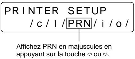 SONY UP-50 - Réglage de la luminosité de la fenêtre d'affichage de l'imprimante - 3