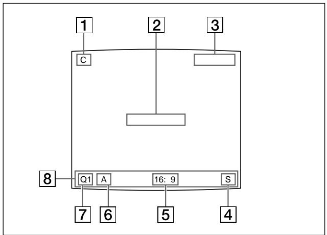 SONY UP-51MDP - Affichage d'écran normal - 1