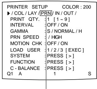 SONY UP-51MDP - Réglage de la tonalité des tirages - 2