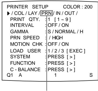 SONY UP-51MDP - Sélection de la fonction de la touche CLEAR - 2